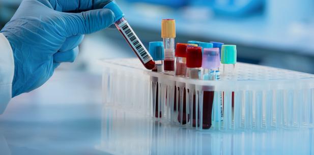 Onderzoeker met buisje bloed in lab