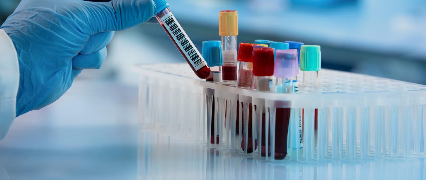 Onderzoeker met buisje bloed in lab