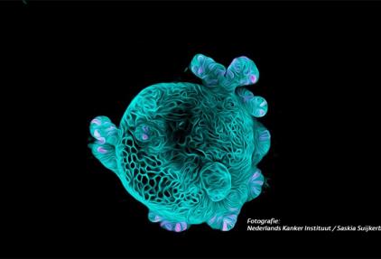 Organoïden: 3D-gekweekte mini-tumoren